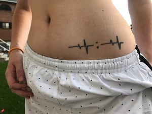 Syracuse University student Emily Dyckman got a tattoo of a lifeline disrupted by a semicolon on her hip to serve as a reminder of her struggles with mental health and anorexia.
